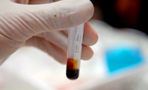 lấy mẫu máu để xét nghiệm ebola