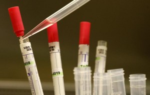 Thử nghiệm vaccen hỗ trợ điều trị virus ebola
