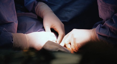 Phẫu thuật hỗ trợ chữa trị rối loạn cương dương ở nam giới là gì