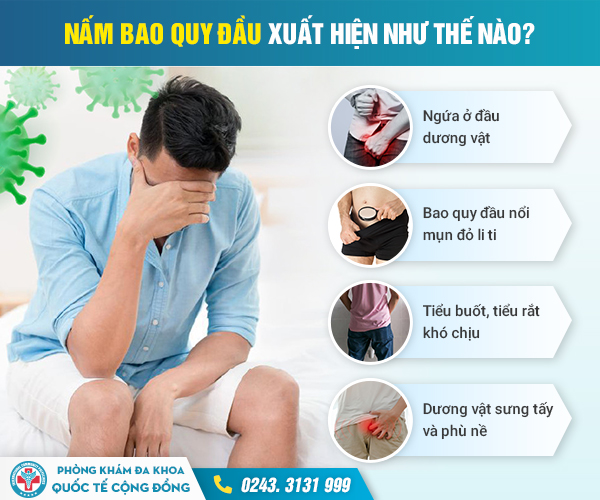 Tất tần tật về chi phí chữa viêm bao quy đầu